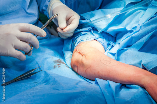 Surgeon suturing the arm of a patient at the end of surgery