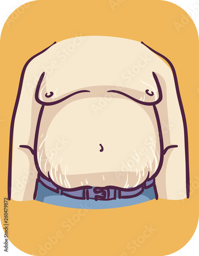 Man Symptom Tummy Stretch Marks Illustration