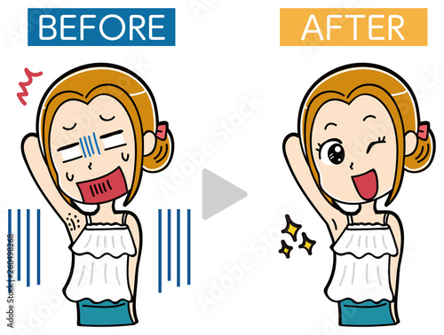 イラスト素材: エステ・女性のムダ毛処理・ビフォーアフター