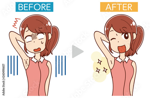 イラスト素材: エステ・女性のムダ毛処理・ビフォーアフター
