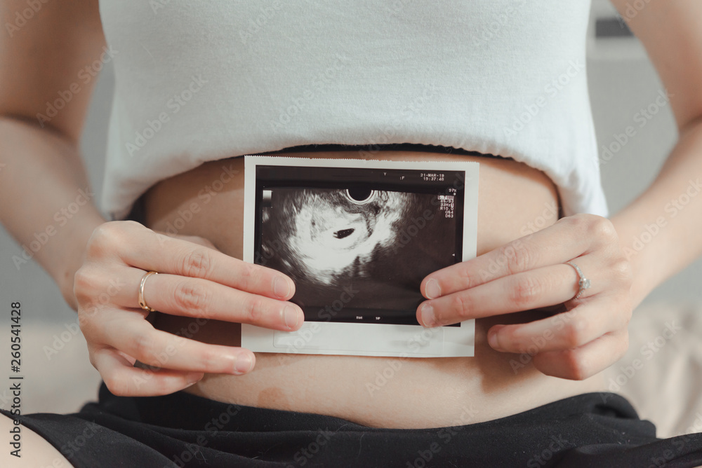 Young pregnant woman looking at 4 Weeks x-ray ultrasound scan of baby Young pregnant woman looking at 4 Weeks x-ray ultrasound scan of baby