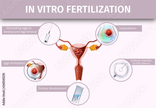 In Vitro Fertilization and Ovulation Background,