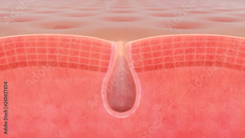 3D illustration of a skin pore
