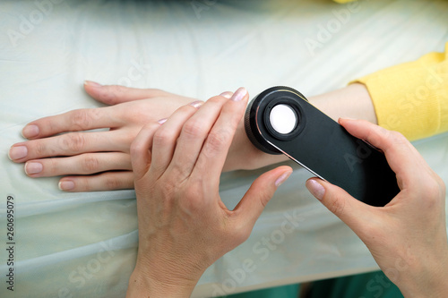 Female dermatologist using a professional dermatoscope while doing skin examination, Checking benign moles on hand. Dermatologist examining birthmarks and moles on a female patient. Dermatology Clinic