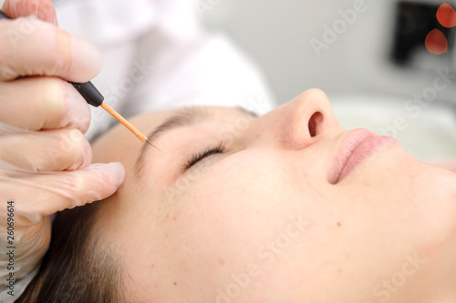 Medical treatment removal of birthmark from female patient's face. Female dermatologist surgeon using electrocautery for removing mole. Radio wave electrocoagulation remove method. Close up