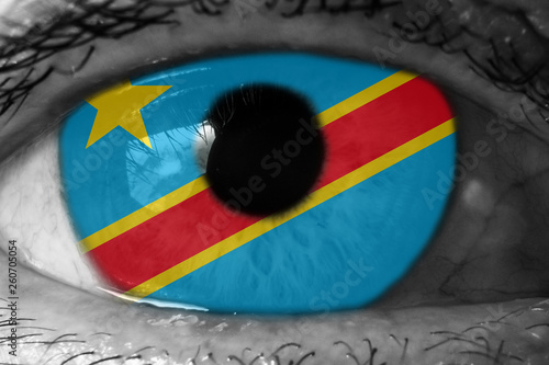 The Democratic Republic of the Congo flag in the eye