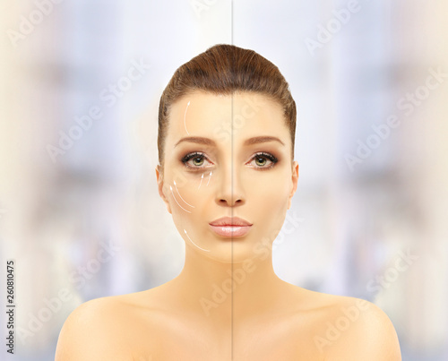 Aging, first signs of aging, appearance of lines,Injectable fillers for corrected variety of cosmetic concerns