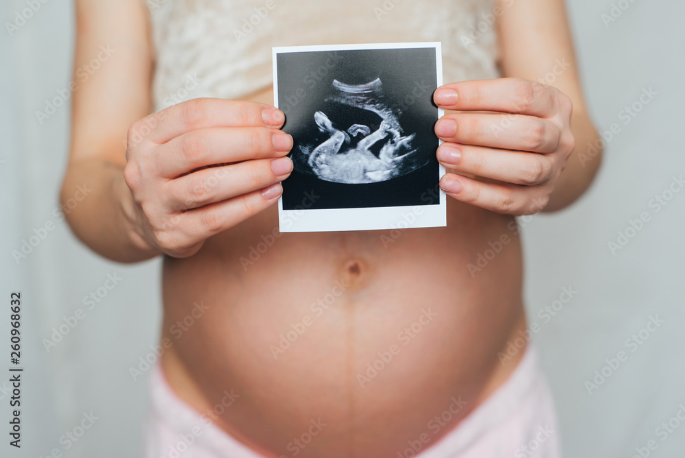 photo ultrasound in the hands of a pregnant girl on a belly background photo ultrasound in the hands of a pregnant girl on a belly background