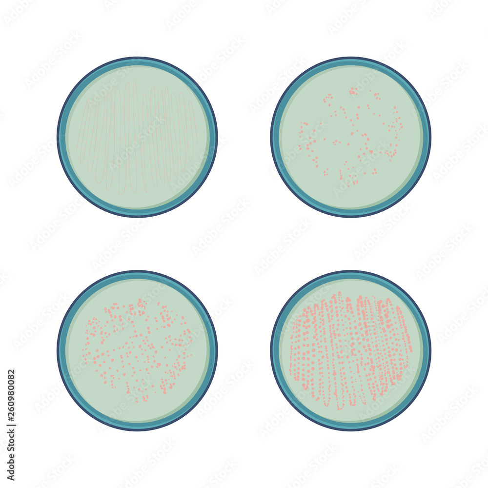 4 stages of bacteria growth in petry dish, colony of microbe, vector