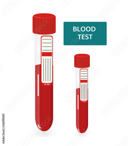Laborotory glass. Vector image of bloodwork. Test tubes with blood for analisis.