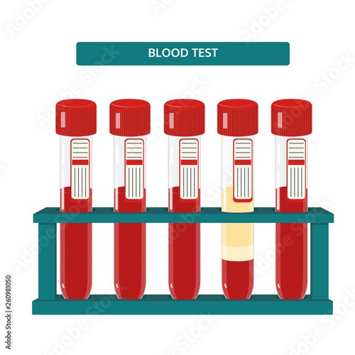 Blood test tubes in rack. Vector medical flat concept.
