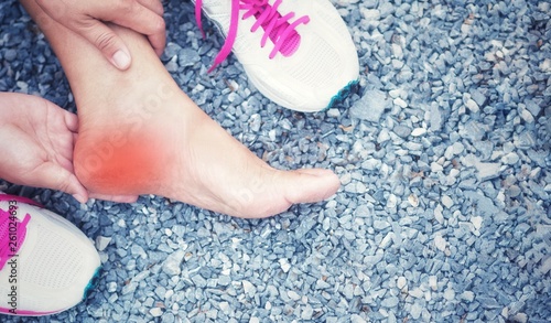 Heel pain and foot (plantar fasciitis). Caused by exercise or running.