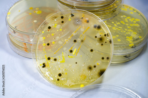 Colonies of different bacteria and mold fungi grown on Petri dish with nutrient agar, close-up view. Microbiology background photo