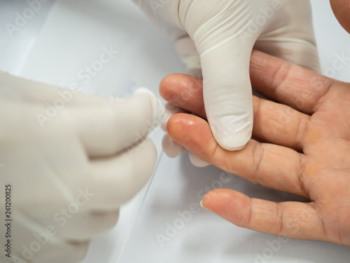Close up of nurse hand using lancet on finger to check blood sugar level with glucose meter at laboratory.Doctor measuring a patient s blood glucose.Human blood sugar test concept