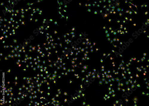 Real fluorescence microscopic view of cancer cells - human melanoma