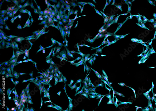 Real fluorescence microscopic view of human skin fibroblasts