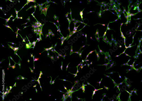 Real fluorescence microscopic view of human skin fibroblasts