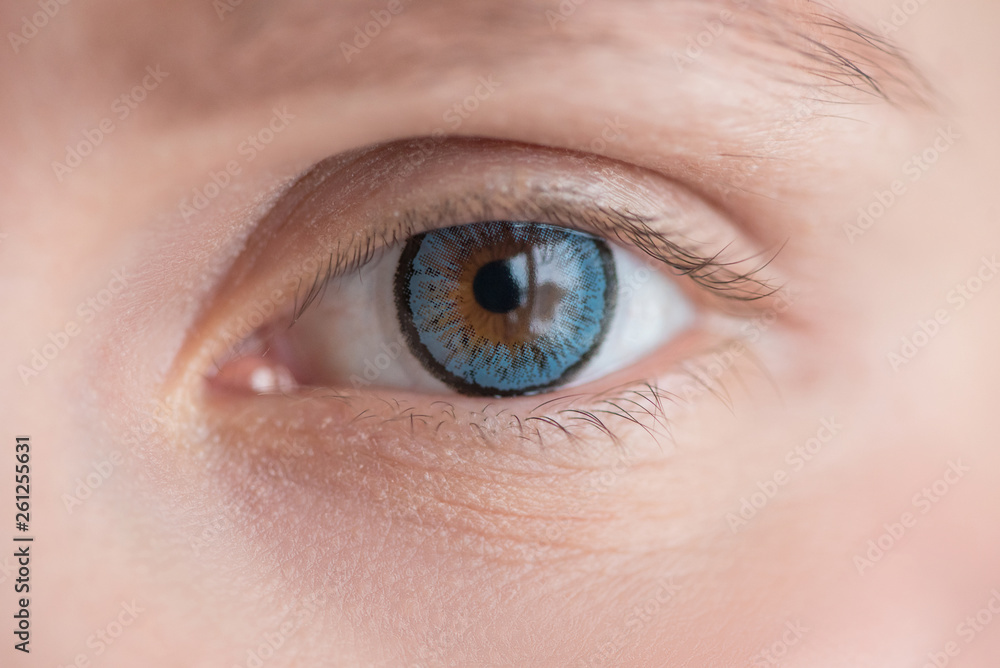 Beautiful eye in blue soft contact lens close up macro Beautiful eye in blue soft contact lens close up macro