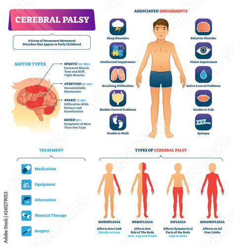Cerebral palsy vector illustration. Permanent movement disorder type scheme photo