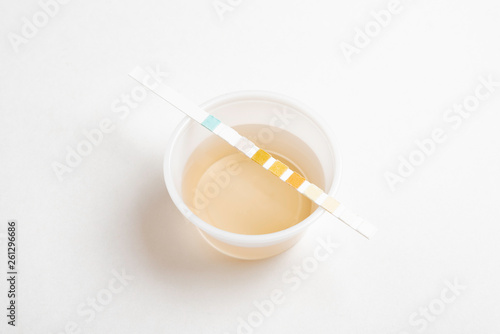 A combination of urine sample in a small round plastic container with a urine reagent strip deliberately and artistically set on a plain white background.