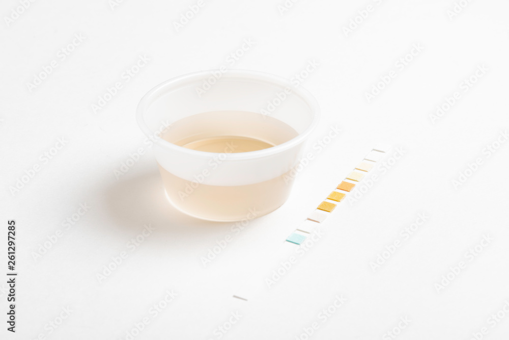 A combination of urine sample in a small round plastic container with a urine reagent strip deliberately and artistically set on a plain white background. A combination of urine sample in a small round plastic container with a urine reagent strip deliberately and artistically set on a plain white background.