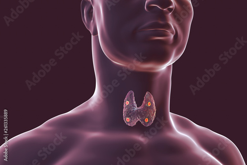 Thyroid and parathyroid glands in human body, 3D illustration photo