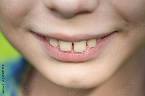 Closeup view of smiling mouth of cute funny white kid. Horizontal color photography. photo