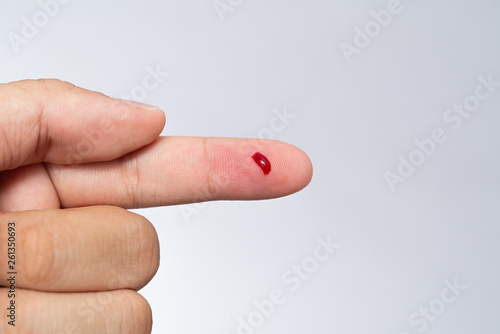 Bleeding blood from the cut finger wound. Injured finger with bleeding open cut wound. Closeup of finger human hand is cut hurt bleeding with bright red blood. 