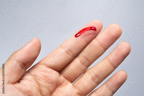 Photos Bleeding blood from the cut finger wound