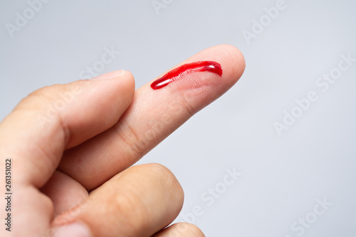 Fotografie, Obraz Bleeding blood from the cut finger wound