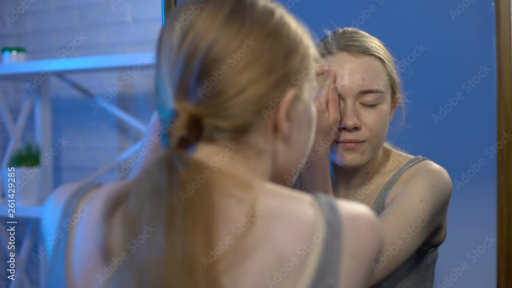 Female teenager popping pimple face, disinfecting by lotion, puberty hormones Female teenager popping pimple face, disinfecting by lotion, puberty hormones