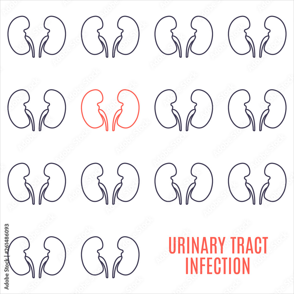 Urinary tract infection kidney disease awareness poster made in linear style on white background. Healthy urinary system medical concept. Human body organ anatomy icon. Vector illustration. Urinary tract infection kidney disease awareness poster made in linear style on white background. Healthy urinary system medical concept. Human body organ anatomy icon. Vector illustration.