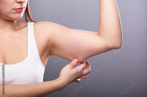 Woman Holding Arm With Excess Fat photo