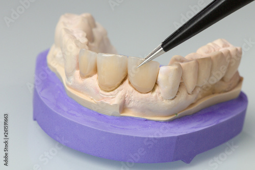 detail work at an artificial dentition in a dental laboratory