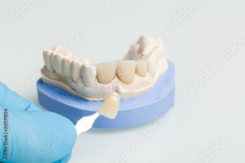 Using a shade guide to check veneer of denture parts in a dental laboratory