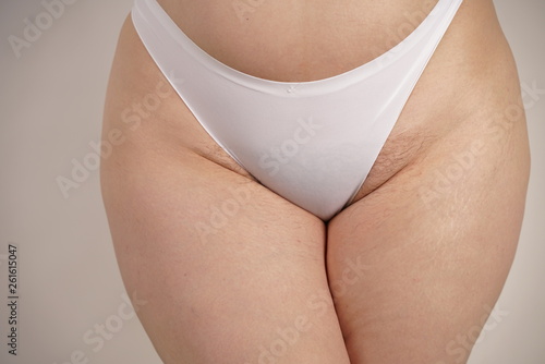 Valokuvatapetti plus size overweight woman with stretches marks on her skin and a hairy crotch standing in white sporty lingerie