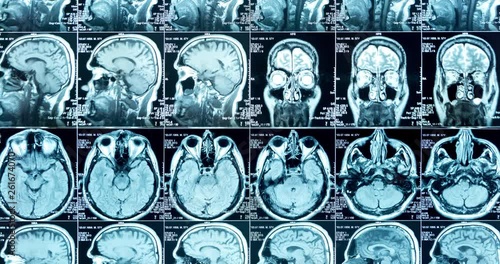 MRI scans in six rows, looped