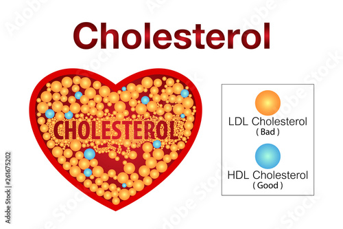 Cholesterol in artery, health risk , vector design