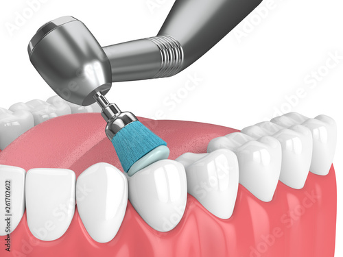 Fotografi 3d render of jaw with dental handpiece and polishing brush