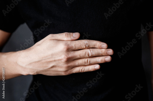 closeup of a hand with vitiligo