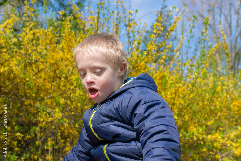 Defect,childcare,medicine and people concept: Blond boy with down syndrome playing in a park at spring time. Defect,childcare,medicine and people concept: Blond boy with down syndrome playing in a park at spring time.