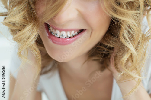 Woman in braces 