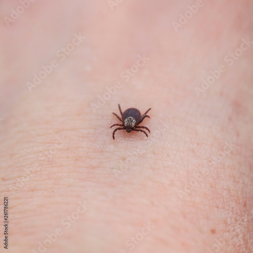 dangerous contagious insect a tick crawling on human skin