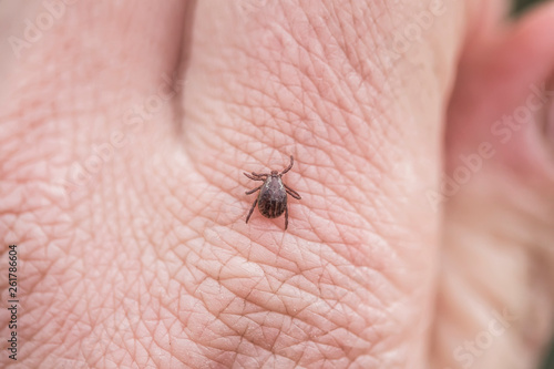 dangerous infectious insect mite crawls on the skin of the human hand to suck the blood