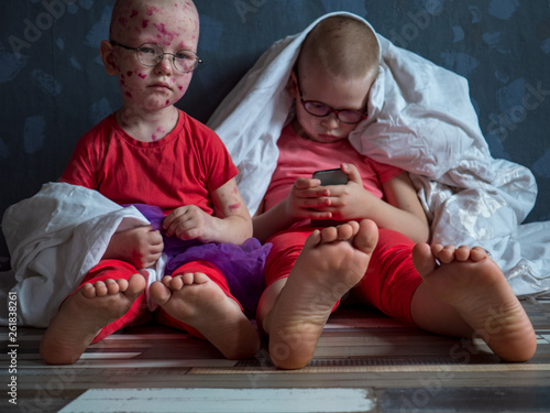 Caucasian children in pink t-shirt with smartphone on floor. Boys posing for camera under white blanket. One of children blond in glasses has chicken pox. Mom smeared follicles with pink solution