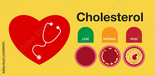 Cholesterol in artery, health risk , vector design
