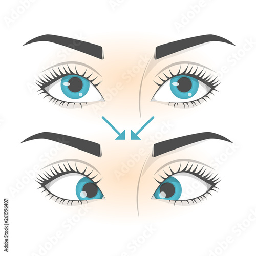 Eye exercise. Movement for eyes relaxation. Eyeball, eyelash