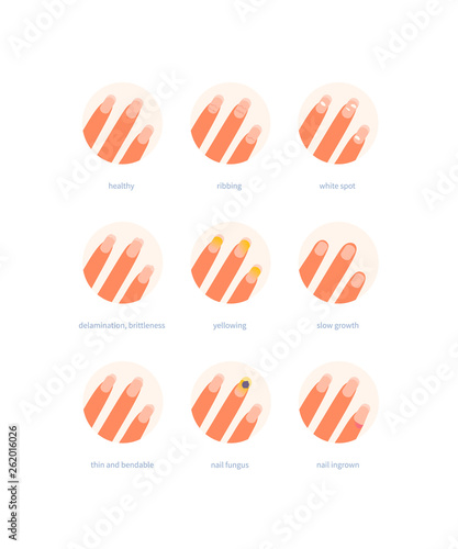 Nails problems vector