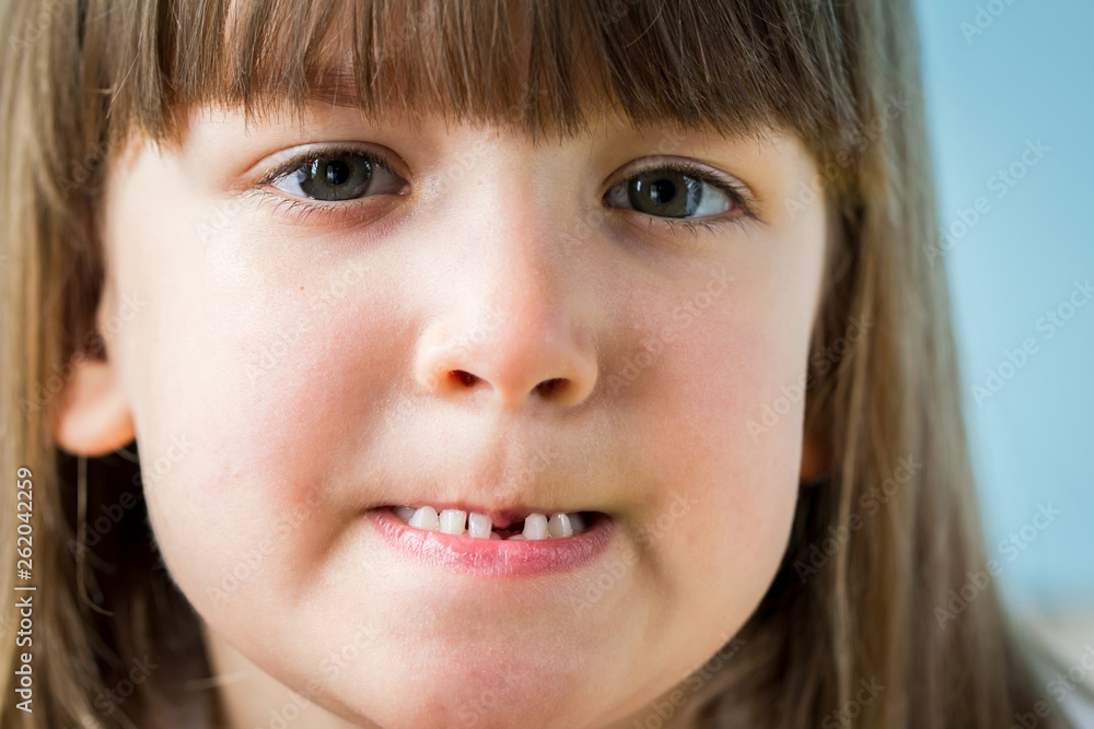 Portrait of adorable kid missing her first milk tooth. Lifetime moments and happy childhood concept. Close up Portrait of adorable kid missing her first milk tooth. Lifetime moments and happy childhood concept. Close up
