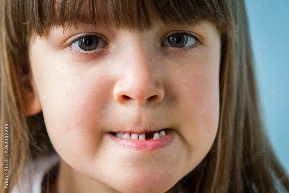 Portrait of cute girl losing her first milk tooth. Close up. Portrait of cute girl losing her first milk tooth. Close up.